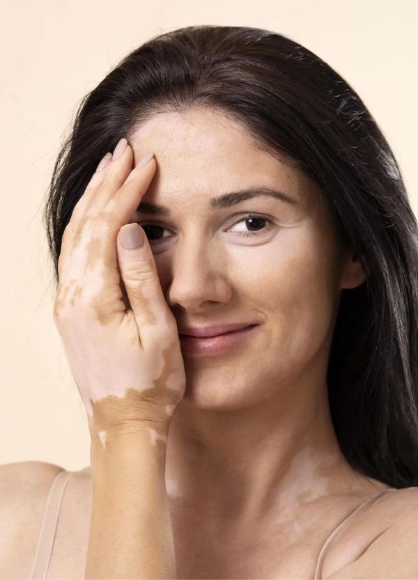 Skin pigmentation